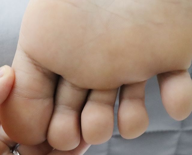 10대 남성 · 7개월 경과